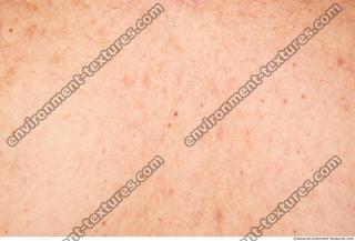 Photo Textures of Human Skin